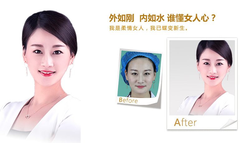 湘潭V脸、线雕隆鼻